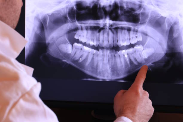Best Emergency Dentist for Knocked-Out Tooth in Ellisville, MO